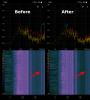 Before_After_Spectroid_arrows.png